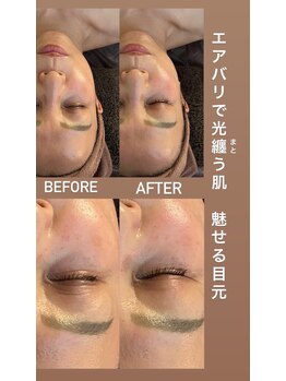 アンミー(anmiiy)/50代エアバリ変化/フェイシャル