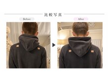 リラボ整体院 赤坂店(RE+LAB=◯整体院)/ビフォーアフター姿勢