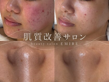 エミレ(EMIRE)の写真