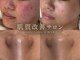 エミレ(EMIRE)の写真