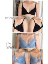 アルアリング 春日原(Alluring)/40代授乳経験者ビフォーアフター