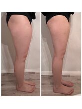 サロン アイリス(salon iRiS)/更に美BODYへ♪