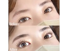 レピア 高槻店/韓国式LEPIA Before&After