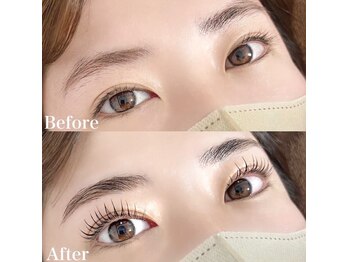 レピア 高槻店/韓国式LEPIA Before&After