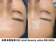 ベリンダ(BELINDA)/セルマンピーリング