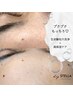 【乾燥肌専用・毛穴つるりん☆】生炭酸毛穴洗浄＋保湿ケア¥13500→¥7500