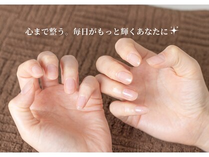 マニュキュア(Manicure)の写真