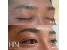 エイトグロー柏(8GLOW)/HBL(ハリウッドブロウリフト)