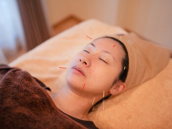 はり灸ソル(はり灸Sol)の写真/【三宮徒歩5分 女性専用鍼灸院】美容鍼で肌のハリを引き出し自律神経や冷えもケアし◎内側から調子を整える