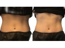 とことん腸を整える！全てオールハンド!感動的な変化を実感★