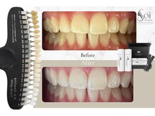 ソイビューティー(Soi beauty)/医療提携で圧倒的トーンアップ◎