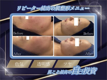 アイリス(airis)の写真