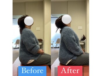 ナオル整体 宮崎院(NAORU整体)/30代女性施術事例【肩こり改善】