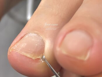 シーエスシーネイル(cscnail)の写真/【健康的な自爪で過ごしたい】1回の施術で見違える!二枚爪、ささくれ、割れやすい。爪に自信がない方へ