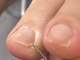 シーエスシーネイル(cscnail)の写真/【健康的な自爪で過ごしたい】1回の施術で見違える!二枚爪、ささくれ、割れやすい。爪に自信がない方へ