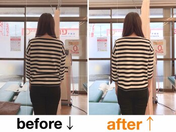 健康工房たいよう整骨院/猫背矯正、骨盤矯正