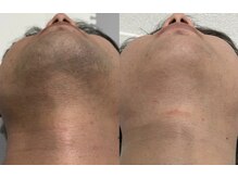 リアル(REAL)/これが日本最高峰マシンの効果！