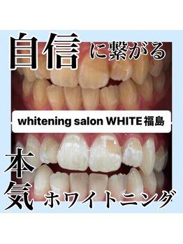 ホワイトニングサロン ホワイト(WHITE)/自信に繋がる本気ホワイトニング