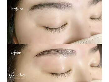 クレー(Klee)/アイブロウリフト