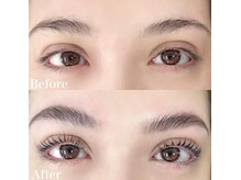 レピア 高槻店/韓国式LEPIA Before&After