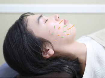 つなぐ/【肌艶アップ・老化予防】美容鍼