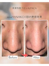 アルパカ(ALPACA)/missHANAKO