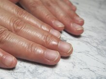 サンマルイチ(301)/自爪育成＋自爪風