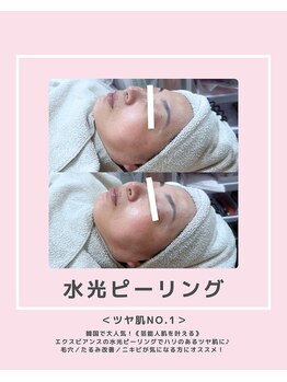 ソワナ(soina)/【神楽坂駅/フェイシャル/毛穴】