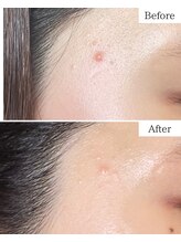 シャムリー(SHAMRY)/TROIAREUKE／スキンメイド