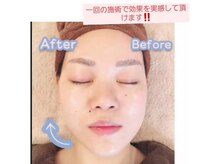 しわたるみ改善!エイジングケアで顔のシミケア/むくみうれい線◎