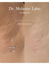 ドクターメラニン ラボ トーキョー 渋谷(Dr. Melanin Labo TOKYO)/黒ずみなどのお悩みに