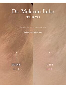 ドクターメラニン ラボ トーキョー 渋谷(Dr. Melanin Labo TOKYO)/黒ずみなどのお悩みに