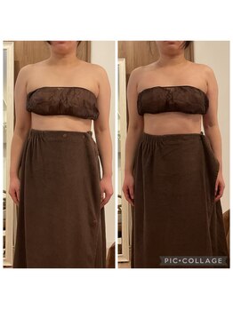 リス(LYS)/[大阪江坂/姿勢矯正]60分×2回