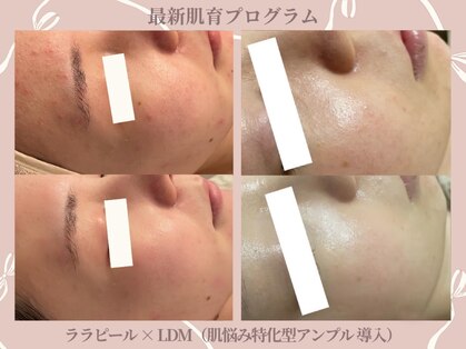 メゾンリュバン 天王寺(Maison Ruban)の写真