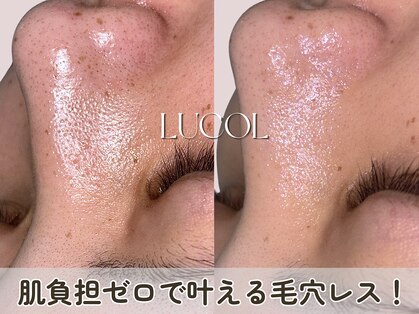 ルコル(LUCOL)の写真