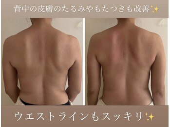 ウララカ(uraraka)/背中が変わればバストも変わる！