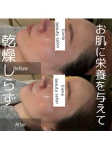 エレナ(Elena)/陶肌トリートメント