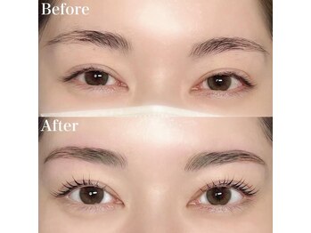 レピア 高槻店/韓国式LEPIA Before&After