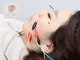 LCFユキ(LCF YUKI)の写真/【話題の美容鍼×驚きの手技で姿勢改善】全身ト-タルサポ-ト×女性院長の１：１施術◎初回お得なクーポン有