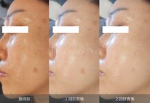 プライベートエステティックサロン アメジスト(AMETHYST)