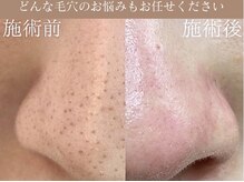 ジェリー(JERRY)の雰囲気(毛穴エクストラクションの後は、角栓・黒ずみ再発予防ケアが◎)