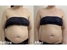 体質を整えながらのダイエットケア☆発汗付き120分 ¥17,600⇒¥12,000
