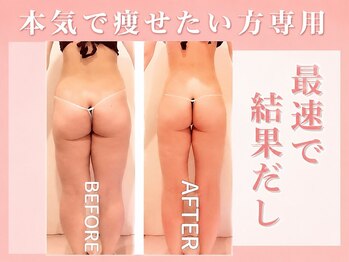 エモーション 横浜関内店(Emotion)の写真/【まだセルフケアで頑張りますか？】パンパンな太もも・垂れたヒップもキュッと引き締めるスピード痩身♪
