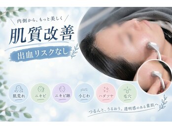 そえ樹の写真/【肌質改善◎】お肌にとても優しい刺激で出血リスクゼロ♪刺す美容鍼から『転がす美容鍼』へ！