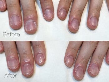 アメリアンドカシェット(Amelie&Cachette)/深爪きょうせい初回：maika