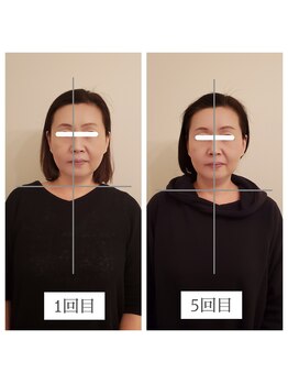 エクラ(eclat)/お客様の変化