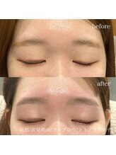 トトノウダケデ/たれ眉が気になるお客様