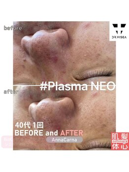 アンナカルナ(AnnaCarna)/お肌荒れや毛穴対策にも