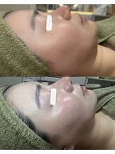 アディ(Adiy)/激的変化！