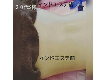 ヨリーズサロン 渡辺通(yoris.salon)の雰囲気（リンパを流すインドマッサージのテクニックで憧れクビレも★）